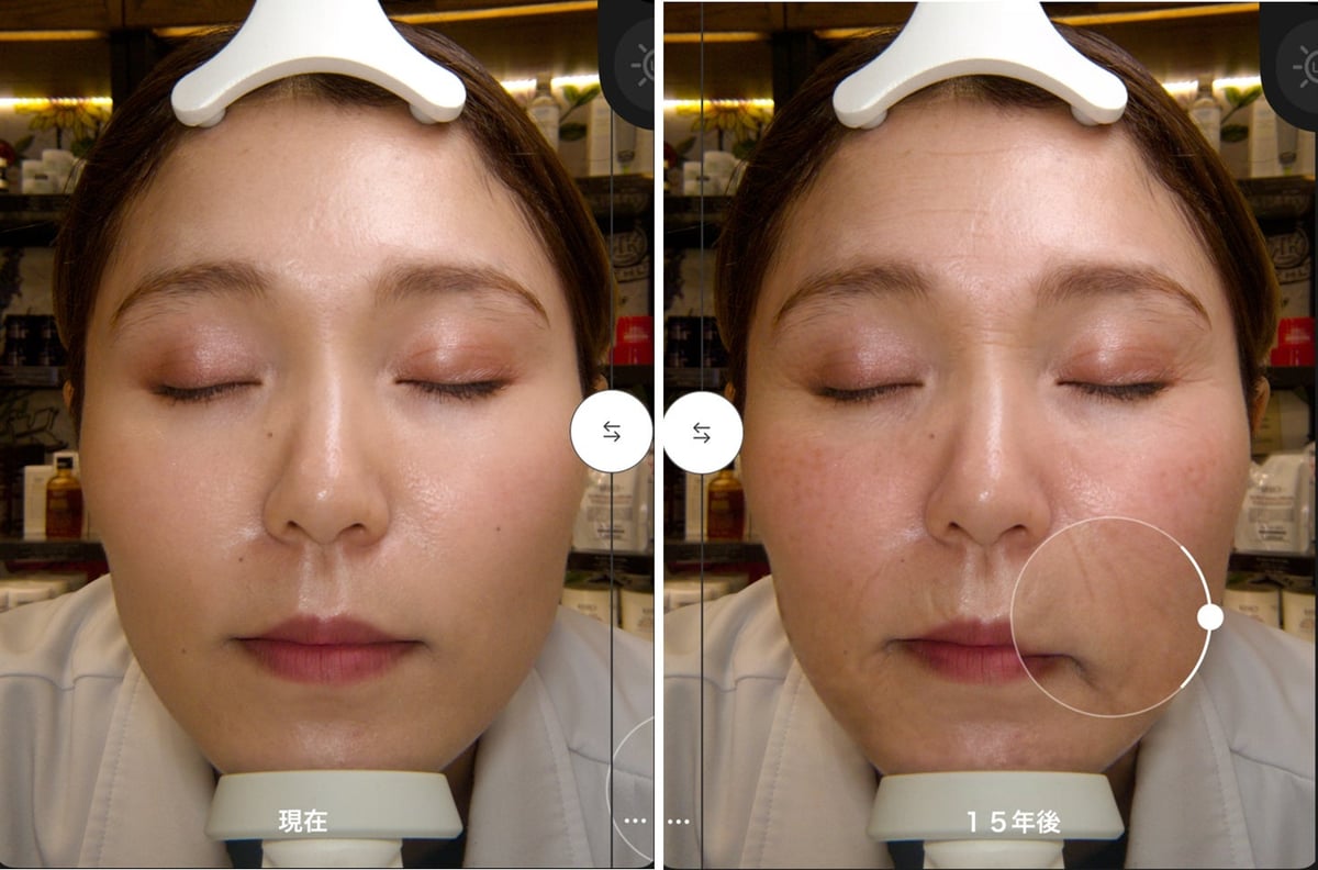 Skin measurement experience image